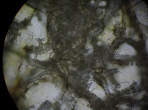 Fig 5. Vein Coil with Sheathing