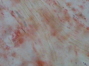Fig 6. Watermelon Meat Veins with Spiral Markings